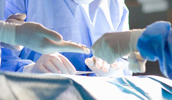 Surgery on the genitals
