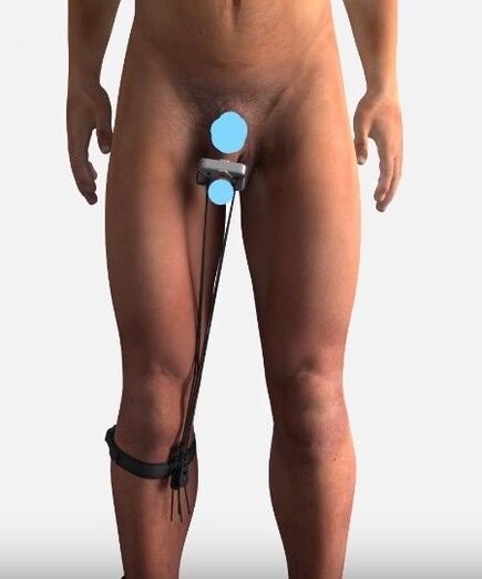 A device for growing a member
